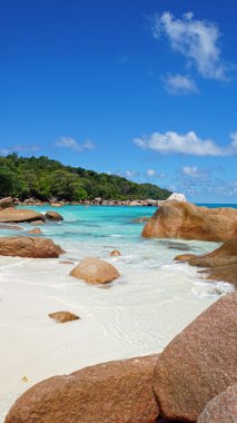 ünlü anse lazio