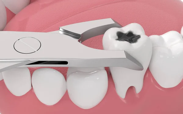 Tandröta Ohälsosamma Tänder Återgivning Digitalritning — Stockfoto