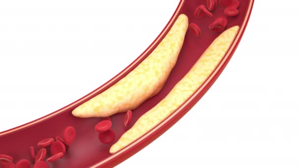 Gordura e células nos vasos sanguíneos, renderização 3d. — Vídeo de Stock