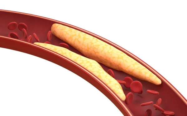 Gordura Glóbulos Vermelhos Nos Vasos Sanguíneos Renderização Desenho Digital Computador — Fotografia de Stock