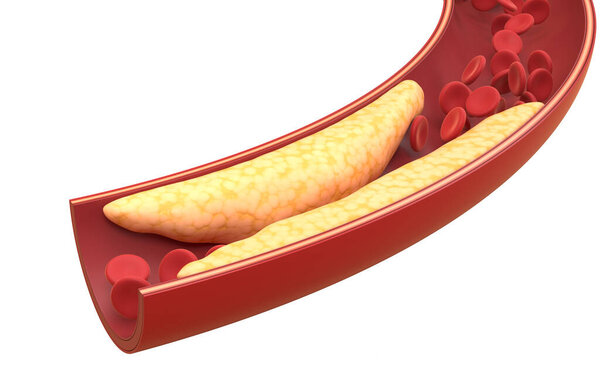 Жировые и красные кровяные тельца в кровеносных сосудах, 3d рендеринг. Цифровой рисунок.