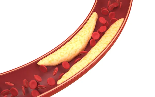 Gordura Glóbulos Vermelhos Nos Vasos Sanguíneos Renderização Desenho Digital Computador — Fotografia de Stock