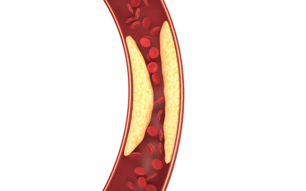 Fette Und Rote Blutkörperchen Den Blutgefäßen Darstellung Digitale Computerzeichnung — Stockfoto