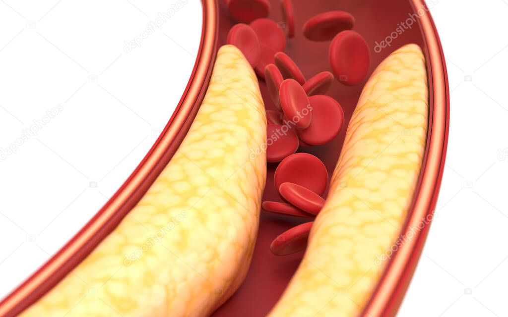 Fat and red blood cells in blood vessels, 3d rendering. Computer digital drawing.