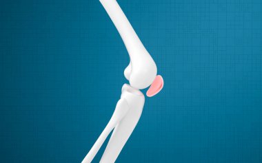 Bacak kemiği ve diz yaraları, üç boyutlu çizim. Bilgisayar dijital çizimi.