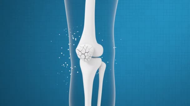 Beinknochen Und Knie Heilen Rendering — Stockvideo