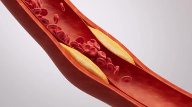 İçinde kan yağı olan kan damarı, 3 boyutlu..