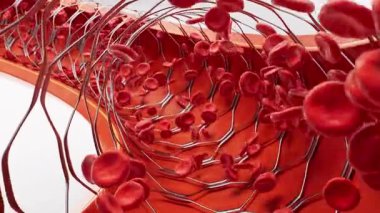 Koroner stent takılı kan damarı, 3 boyutlu..