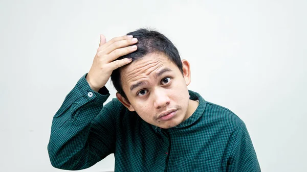 一张年轻的亚裔马来人的画像 检查他头上的脱发情况 头发稀疏而稀疏 — 图库照片