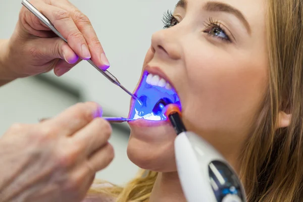 Patient féminin traité avec un équipement dentaire pour déterminer la couleur précise des dents — Photo