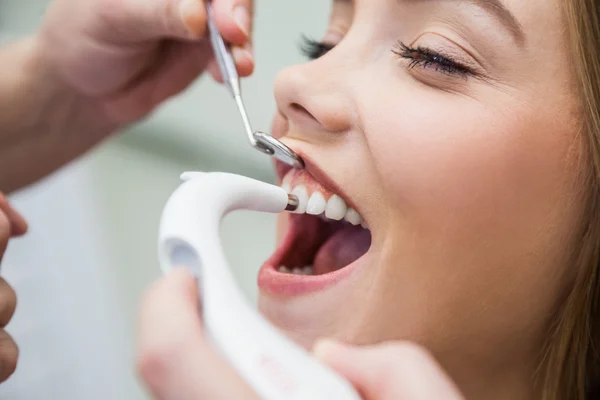 Paciente fêmea tratada com equipamento dentário para a cor precisa do dente da determinação — Fotografia de Stock