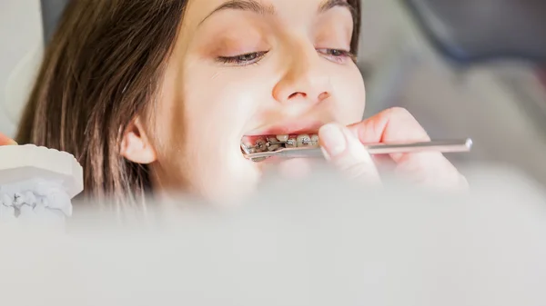 Обстеження стоматолог — стокове фото