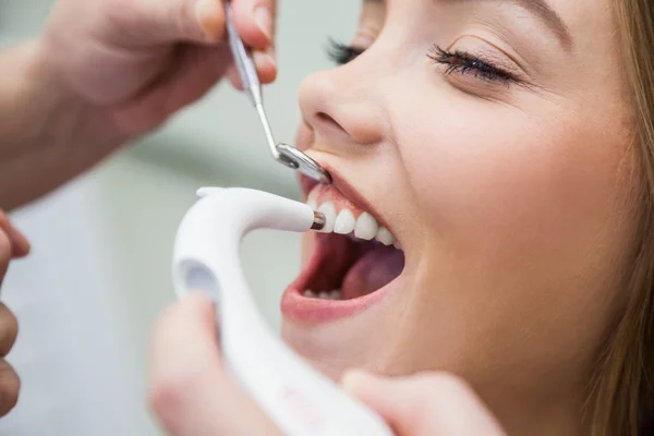 Bayan hasta belirlenmesi doğru diş rengi için diş ekipman ile tedavi - Stok İmaj