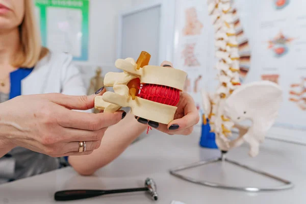 Doctor physiotherapist explaining the mechanism of injury of spine using vertebra model at the hospital. Selective focus.