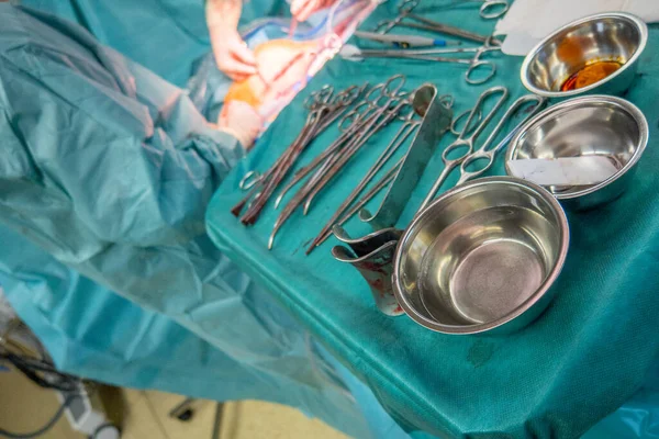 Tijdens Een Operatie Worden Verschillende Chirurgische Instrumenten Een Operatietafel Geplaatst — Stockfoto