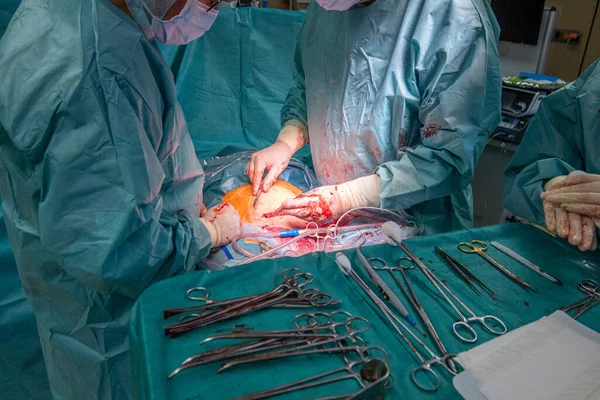 a gynecologist sews a stomach back together after a caesarean section