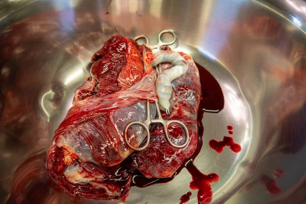 Een Placenta Met Navelstreng Zit Een Zilveren Zoute Schaal Een — Stockfoto