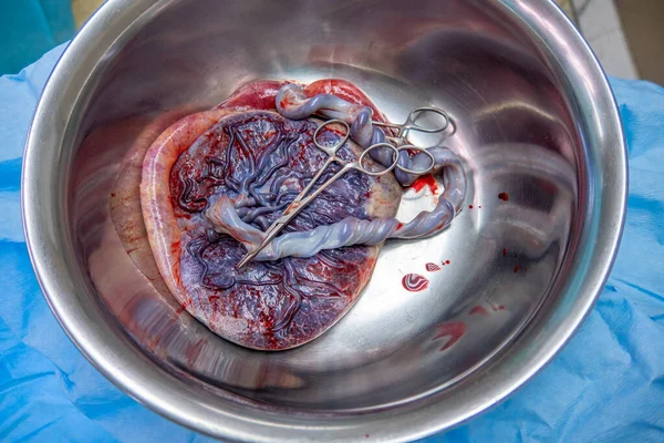 Göbek bağı olan bir plasenta, doğumdan sonra gümüş bir salin kasesinde bulunur.