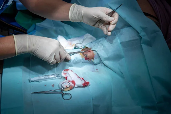 Kirurg Suturer Ett Litet Sår Patient Med Nålhylsa Och Tång — Stockfoto