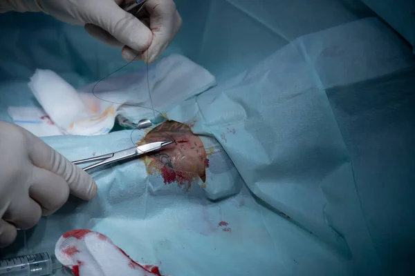 Chirurgo Sutura Una Piccola Ferita Paziente Con Ago Forcipe — Foto Stock