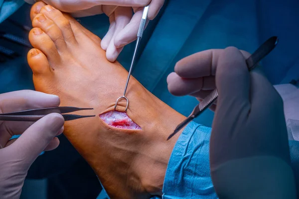 Bir Cerrah Bir Ayağıyla Neşterle Bir Kesik Atar — Stok fotoğraf