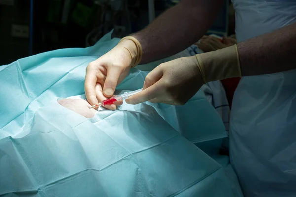 Bir Doktor Bir Kanül Şırıngayla Bir Ameliyathanede Diz Delinmesi Yapar — Stok fotoğraf