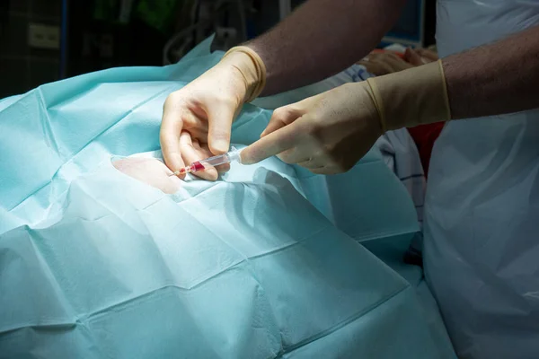 Bir Doktor Bir Kanül Şırıngayla Bir Ameliyathanede Diz Delinmesi Yapar — Stok fotoğraf