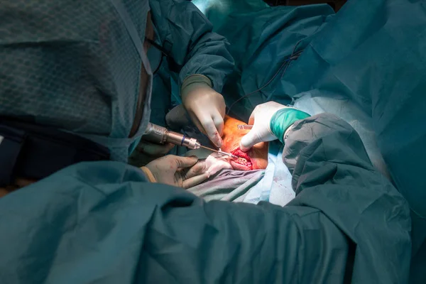 Під Час Операції Перелом Ліктя Лікують Лікарі Титановою Плитою — стокове фото