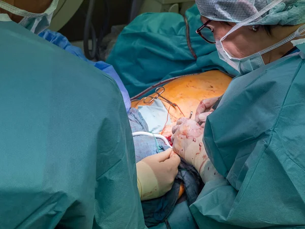 Bir Damar Cerrahı Tıkanmış Bir Atardamar Için Bypass Olarak Yapay — Stok fotoğraf
