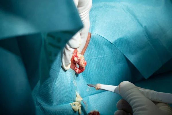 Egy Sebész Felnyit Egy Nagy Tályogot Egy Szikével Kórházban — Stock Fotó