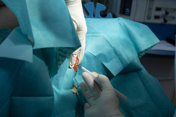 a surgeon opens a large abscess with a scalpel in a hospital