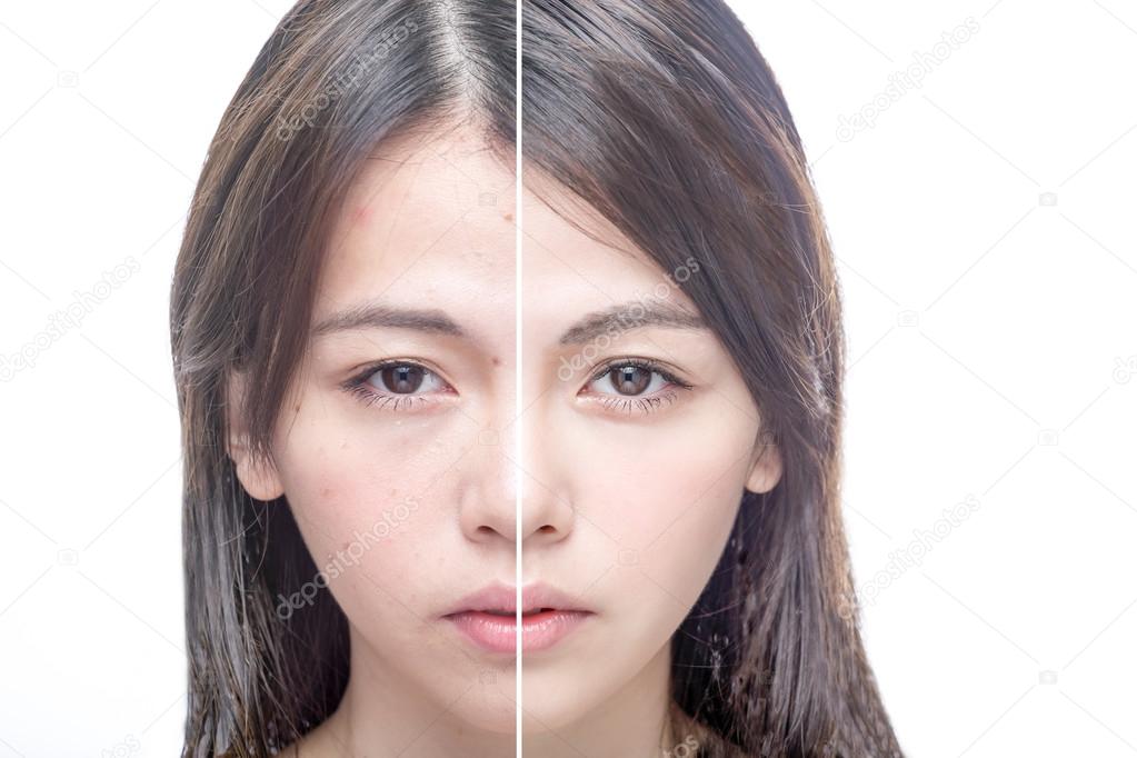 Before and after beauty portrait