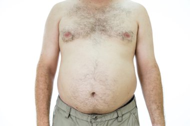 Adam şişman mide ile