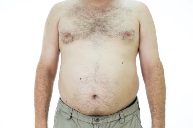 Adam şişman mide ile