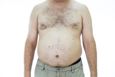 Adam şişman mide ile