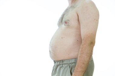 Adam şişman mide ile