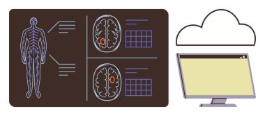 Bulutun altındaki bir bilgisayar ekranına bağlı beyin taraması detaylarına sahip insan anatomisi. Sağlık hizmetleri, yapay zeka, teletıp, bulut depolama, tanı, tıbbi araştırma, dijital dönüşüm için ideal