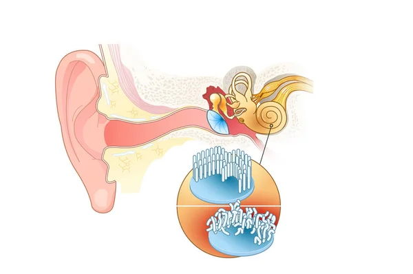 耳蜗内的耳鸣 健康和受损的毛细胞 — 图库照片