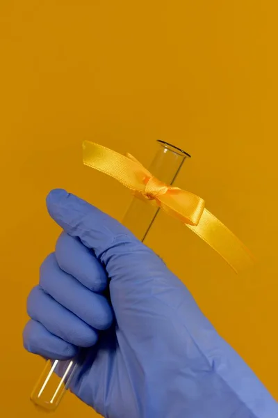 The hand in the blue rubber glove squeezes a test tube with a yellow ribbon tied with a bow at the neck. On a, right.