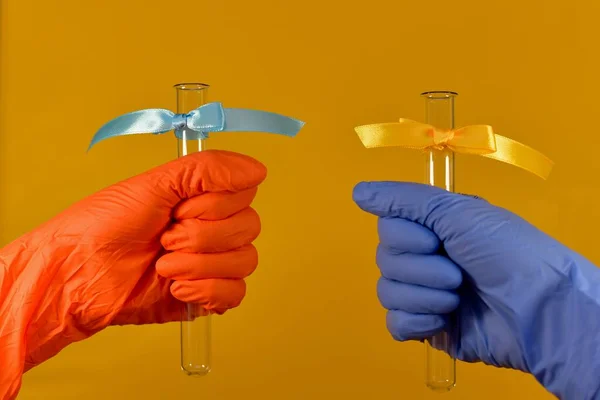 Dos manos en diferentes colores de guantes de goma. En cada tubo de ensayo con arcos diferentes. Sobre un fondo amarillo. —  Fotos de Stock