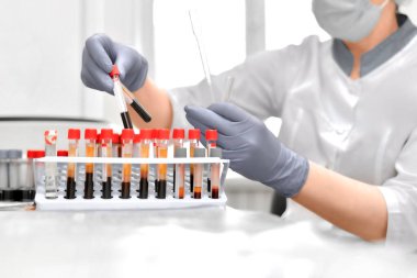 Test tüplerindeki kan testleriyle uğraşırken laboratuvar asistanının elleri.