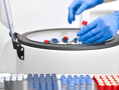 Test tüplerini laboratuvar santrifüjüne yerleştiren eldivenli eller..