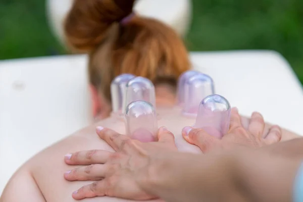 Woman masseur doing massage with vacuum cups on back outdoors. Cupping treatment at spa. Traditional Chinese medicine. Stock Photo