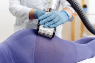 Özel mor takım elbiseli bir kadın spa salonunda selülit karşıtı masaj yaptırıyor. LPG masaj prosedürü. Lipomasaj aleti tutan terapistin elleri