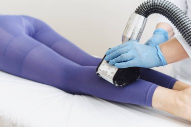 LPG bacak ameliyatı yapan genç bir kadın. Reklamcılık. Lenfatik drenaj masajı LPG aygıtı süreci