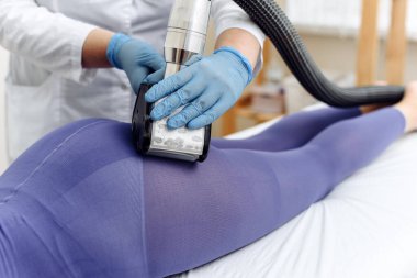 LPG, ve klinikte vücut şekillendirme tedavisi. Güzel bir kadın kalçasında LPG makinesiyle selülite karşı güzellik terapisi görüyor.