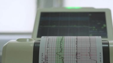 Elektronik Kardiyografi Makinesi rahmin fetal kalp kasılmalarını izliyor. Hamilelik sırasında doğum koğuşunda elektrokardiyogram çıktı. Tıbbi Teşhis Ekipmanı.