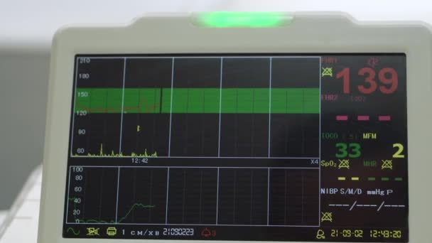 Elektronická Kardiotokografie Stroj Monitorování Fetální Srdeční Kontrakce Dělohy Tisk Kardiogram — Stock video