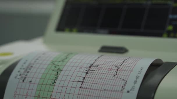 Elektronisk kardiotocografi Maskinövervakning av fetala hjärtkontraktioner i Uterus. Utskrift Kardiogram rapport kommer ut elektrokardiogram i arbete Ward under graviditeten. Medicinsk diagnostisk utrustning — Stockvideo