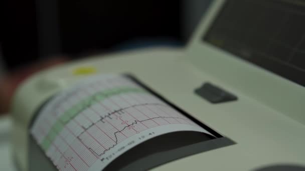 Cardiotografia elettronica Monitoraggio automatico delle contrazioni cardiache fetali dell'utero. Stampa del rapporto sul cardiogramma in uscita Elettrocardiogramma nel reparto travaglio durante la gravidanza. Apparecchiature diagnostiche mediche — Video Stock